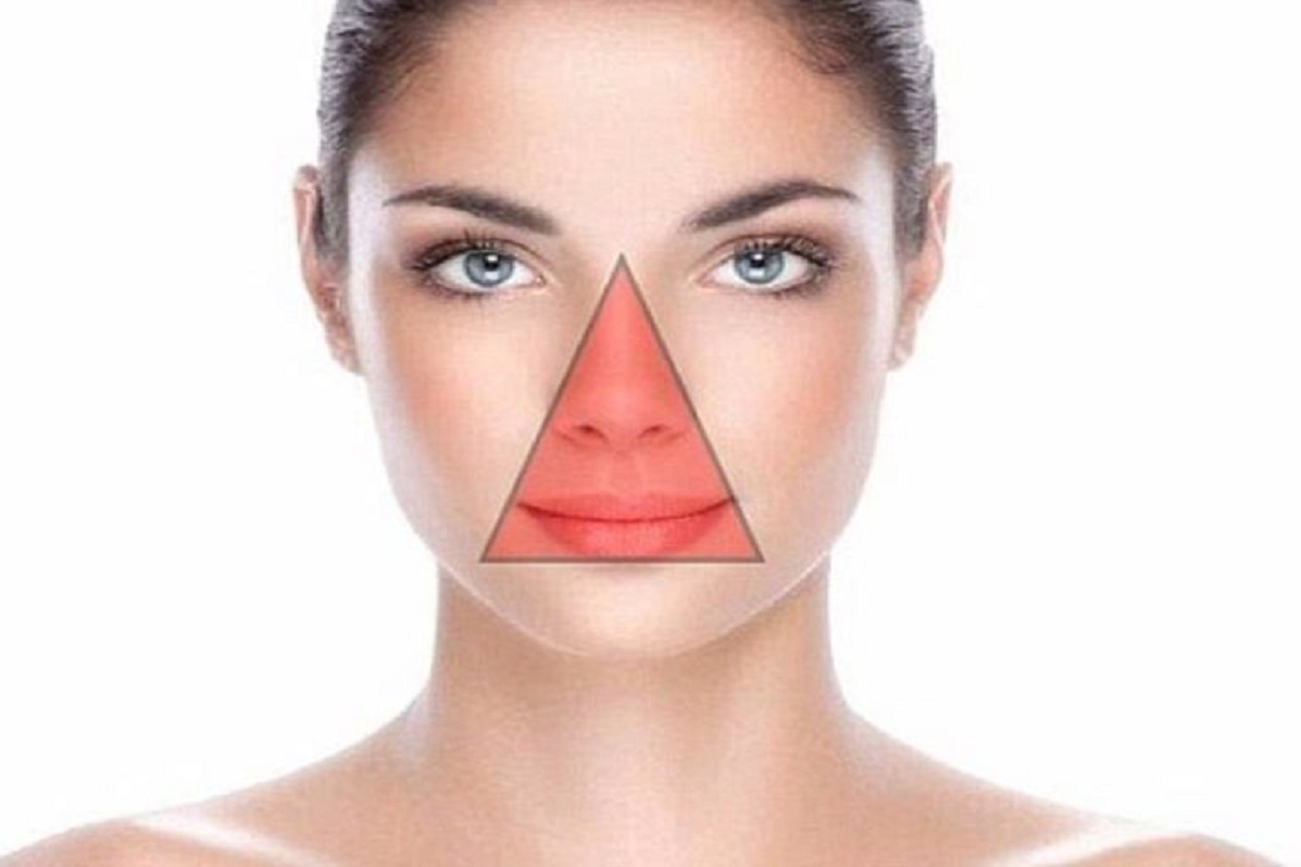 Треугольник вокруг рта